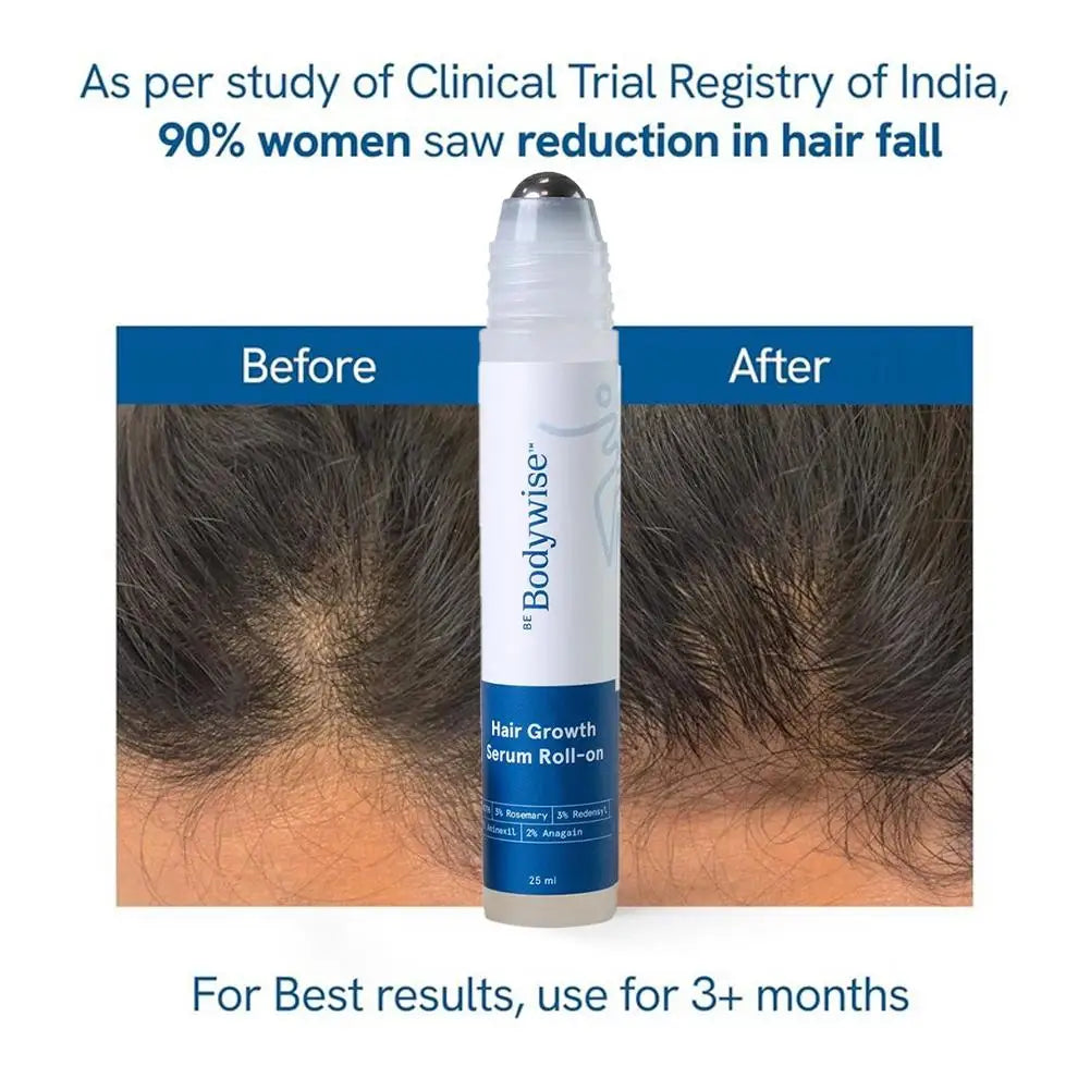 Revitalize Your Hair with 25Ml Rosemary Hair Growth Serum - Nourishing Scalp Treatment for Frizz Control and Strengthened Roots