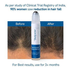 Revitalize Your Hair with 25Ml Rosemary Hair Growth Serum - Nourishing Scalp Treatment for Frizz Control and Strengthened Roots