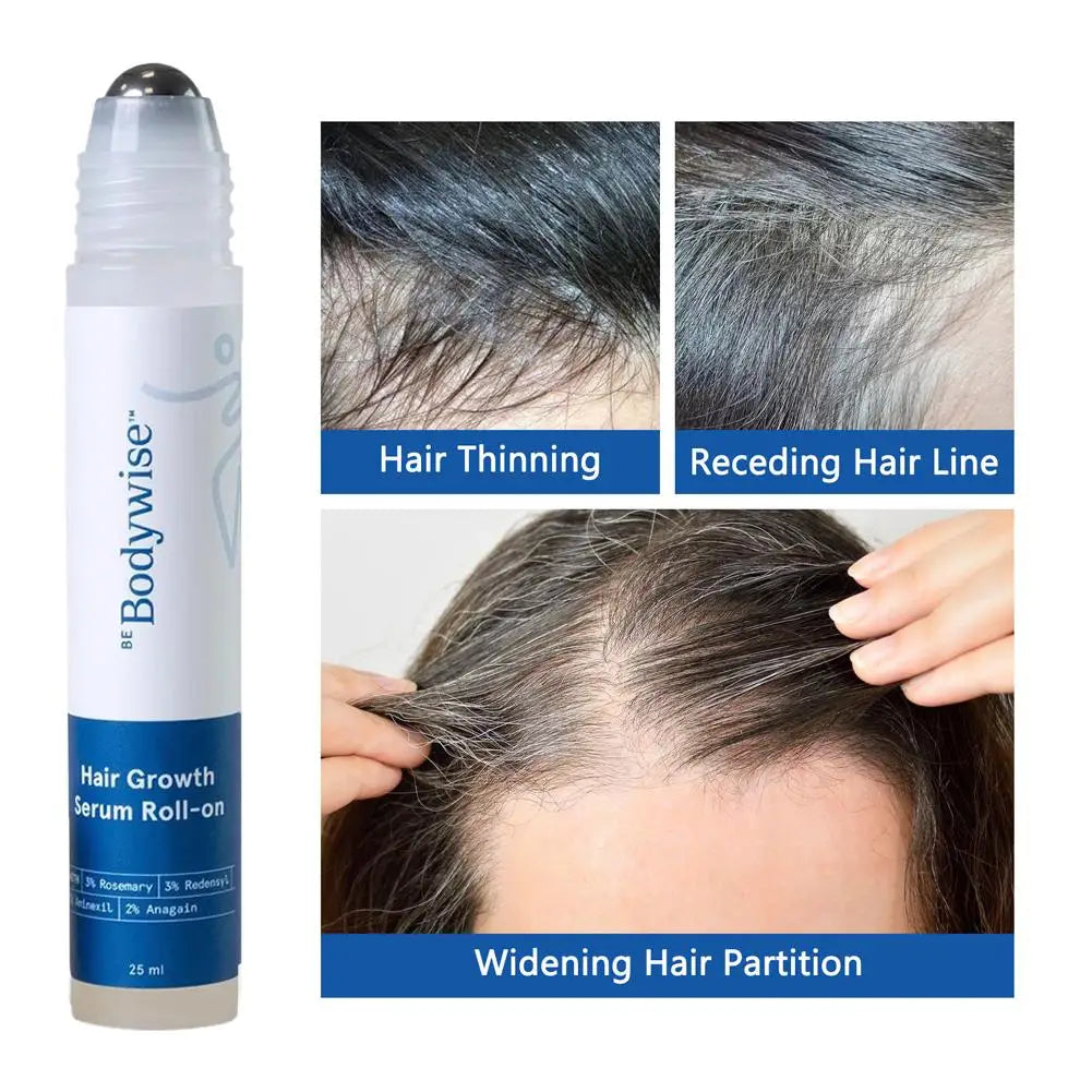 Revitalize Your Hair with 25Ml Rosemary Hair Growth Serum - Nourishing Scalp Treatment for Frizz Control and Strengthened Roots